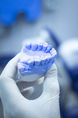 Dental mold dentist clay teeth ceramic plate model cast clipart