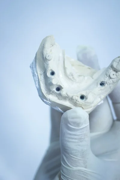 Fogászati penész fogorvos agyag fogak kerámia tányér modell leadott — Stock Fotó