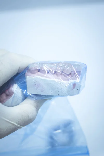 Stampo dentale dentista denti in argilla modello di piatto in ceramica fuso — Foto Stock