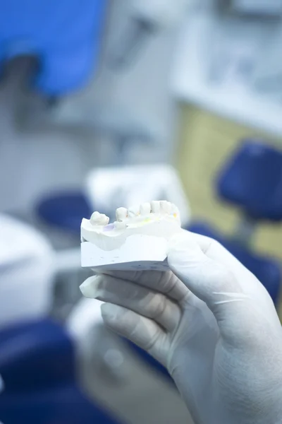 Dental mold dentist clay teeth ceramic plate model cast — Stock Photo, Image