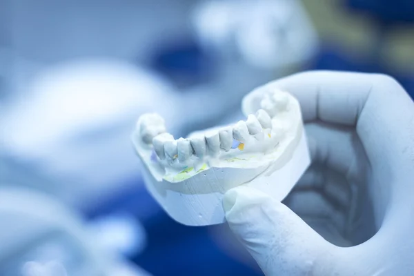 Moule dentaire dentiste dents en argile plaque de céramique modèle coulé — Photo