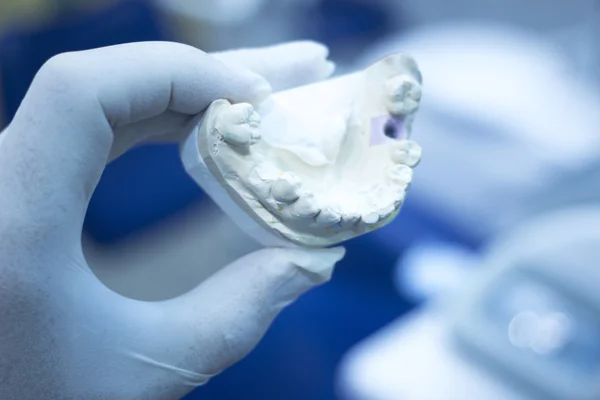 Tandheelkundige schimmel tandarts klei tanden keramische plaat model gegoten — Stockfoto