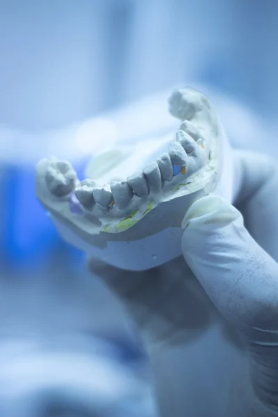 Dental hometta hammaslääkäri savi hampaat keraaminen levy malli valettu — kuvapankkivalokuva