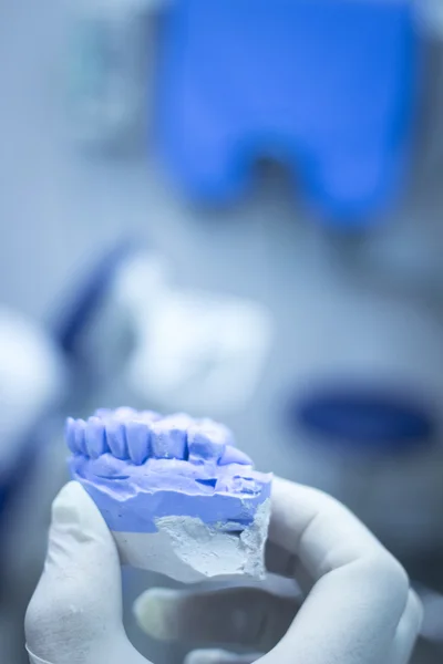 Stampo dentale dentista denti in argilla modello di piatto in ceramica fuso — Foto Stock