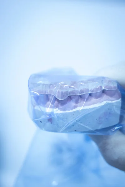 Zahnform Zahnarzt Ton Zähne Keramikplatte Modell gegossen — Stockfoto
