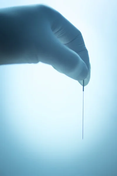 Doctor hand acupuncture needle dry needling — Stock fotografie