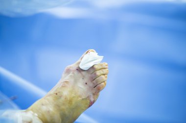 Hastane ameliyathane Medikal Cerrahi operasyon