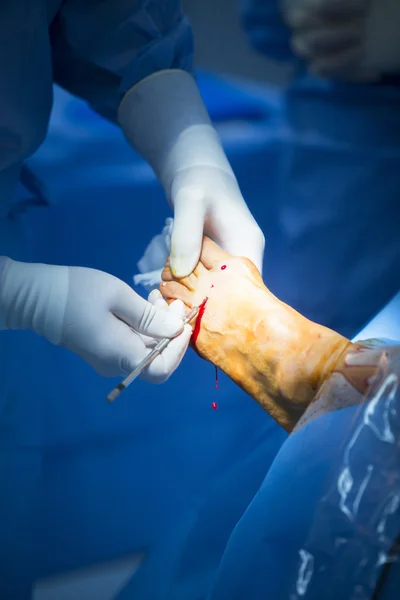 Ziekenhuis operatiekamer medische ingreep werking — Stockfoto