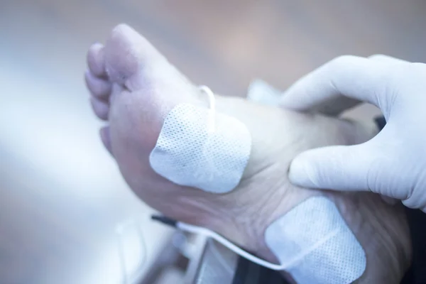 Лечение физиотерапии ног пациента — стоковое фото
