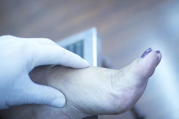 Patient Fuß in Physiotherapie Physiotherapie — Stockfoto