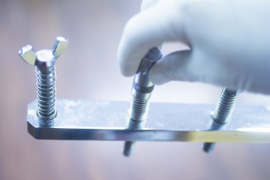 El Bilek parmak fizik tedavi rehabilitasyon