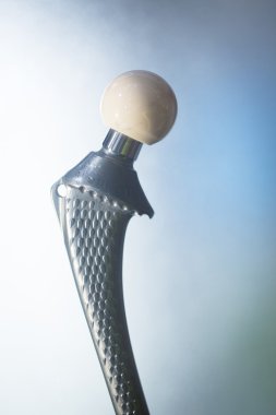 Travmatoloji ortopedik cerrahi hip implant