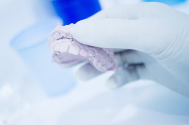 Diş kalıp diş hekimleri kil diş seramik tabak döküm