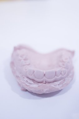 Diş kalıp diş hekimleri kil diş seramik tabak döküm