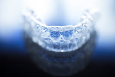 Görünmez diş diş parantez aligners diş teli hizmetli