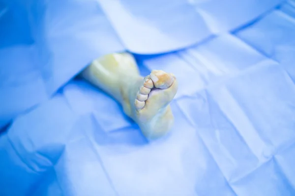 Sala de cirurgia hospitalar cirurgia médica operação — Fotografia de Stock