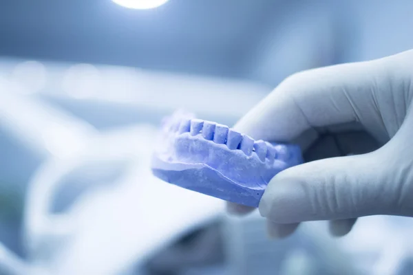 Molde dental dentistas dientes de arcilla placa de cerámica fundido — Foto de Stock