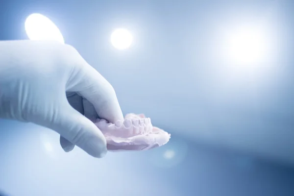 Dentistas molde dentário dentes de argila placa cerâmica elenco — Fotografia de Stock