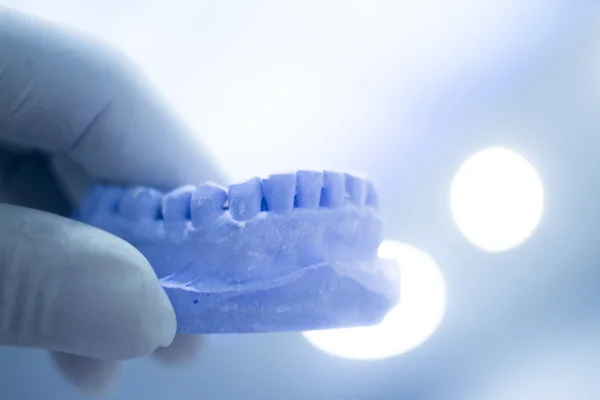 Dentisti stampo dentale denti di argilla piatto in ceramica fuso — Foto Stock