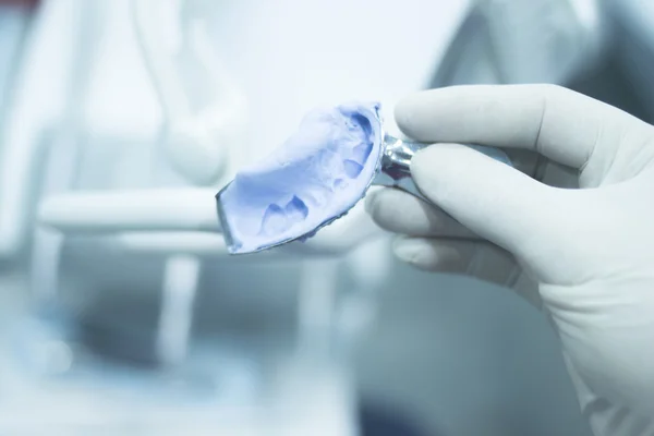 Tandheelkundige schimmel tandartsen klei tanden gel gom plaat gegoten — Stockfoto