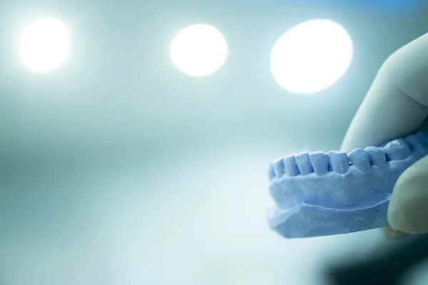 Dentistes moule dentaire dents d'argile plaque en céramique coulée — Photo