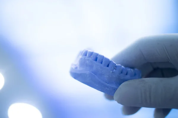 Formy dentystyczny Dentyści gliny zęby płytki ceramicznej oddanych — Zdjęcie stockowe