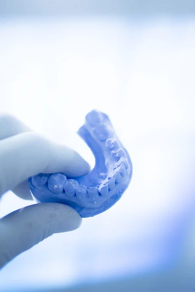 歯の型の歯科医粘土歯セラミック板キャスト — ストック写真
