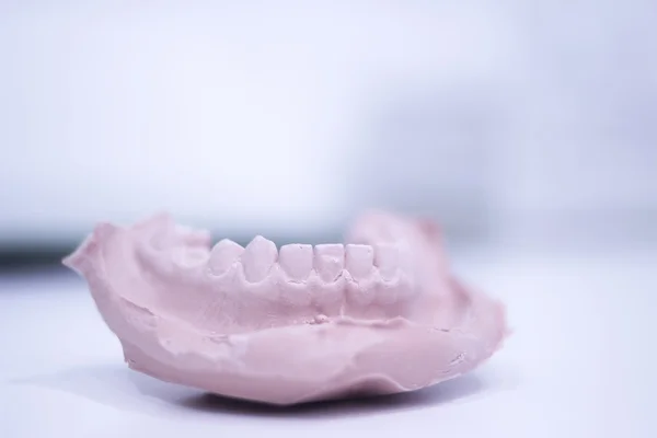 Dental mold dentists clay teeth ceramic plate cast — Stock Photo, Image