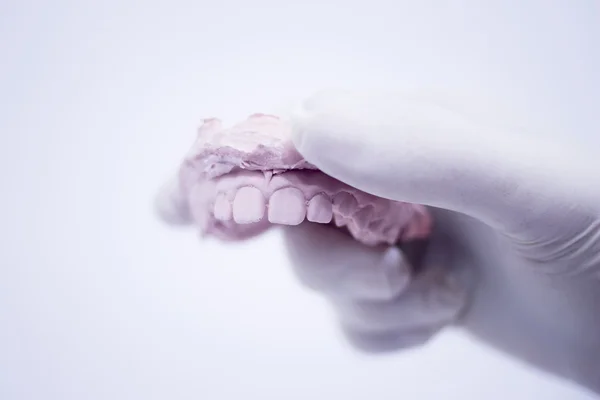 Dentistas molde dentário dentes de argila placa cerâmica elenco — Fotografia de Stock