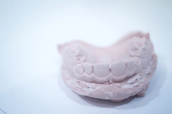 Molde dental dentistas dientes de arcilla placa de cerámica fundido — Foto de Stock