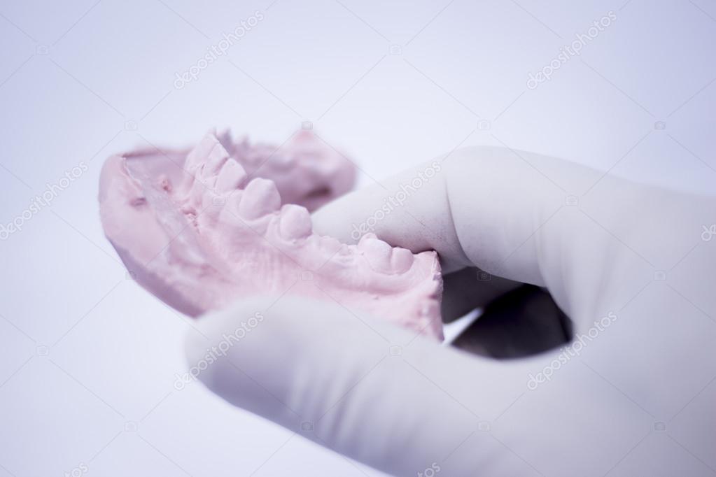 Dental mold dentists clay teeth ceramic plate cast — Stock Photo