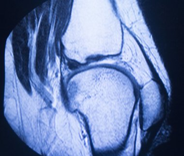 Mr manyetik rezonans görüntüleme tıbbi tarama 
