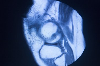 Mr manyetik rezonans görüntüleme tıbbi tarama 