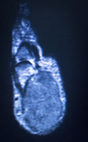 Mri 核磁気共鳴医学 — ストック写真