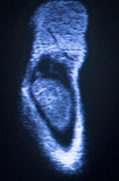 MRI mágneses Zengés Elképzelhető könyök kar vizsgálat — Stock Fotó