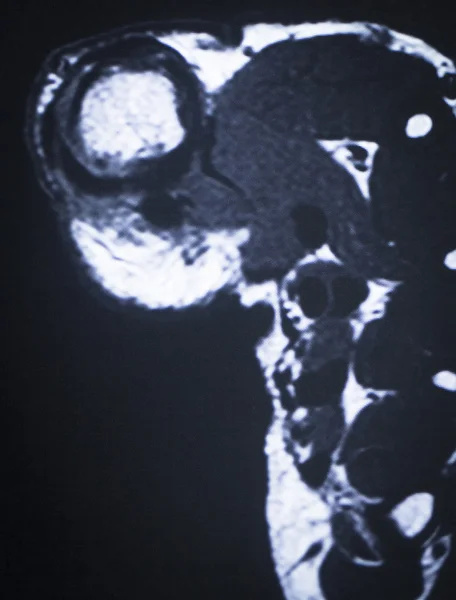 MRI mágneses Zengés Elképzelhető láb, lábujjak scan — Stock Fotó