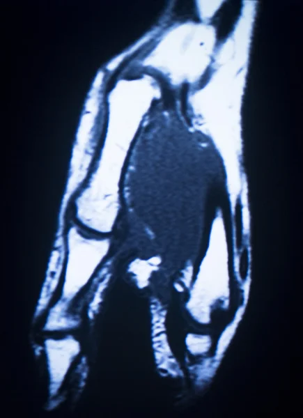 Mri 磁共振成像医学扫描 — 图库照片