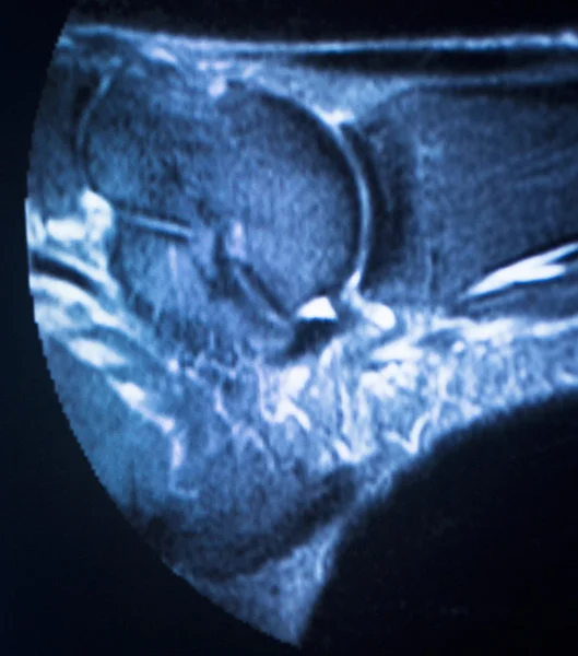 Mr manyetik rezonans görüntüleme ayak bileği tarama — Stok fotoğraf