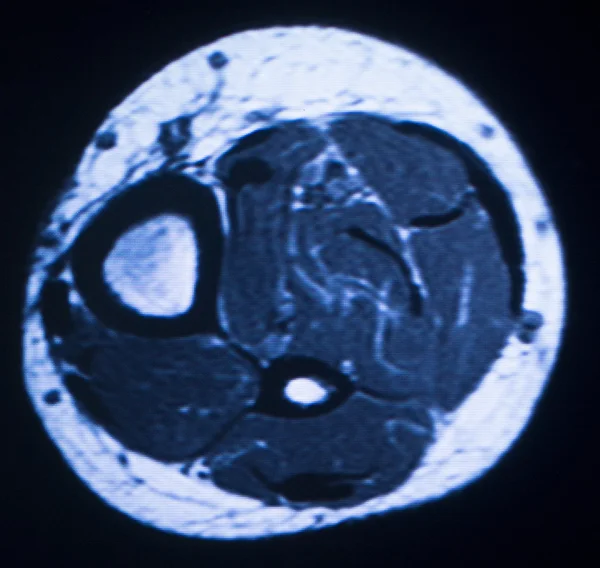 Mri 核磁気共鳴医学 — ストック写真