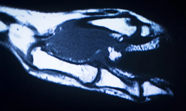 Mri 자기 공명 영상 의학 검사 — 스톡 사진