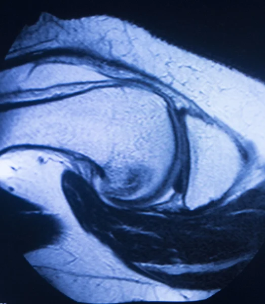 Ressonância magnética MRI varredura médica — Fotografia de Stock