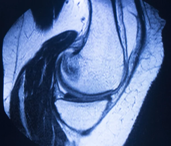 Mri 磁共振成像医学扫描 — 图库照片