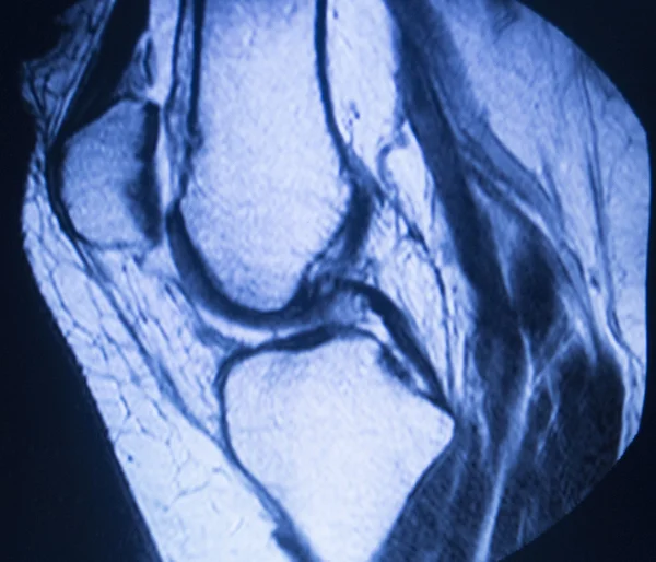 Mri 磁共振成像医学扫描 — 图库照片