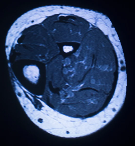 Mri 磁共振成像医学扫描 — 图库照片