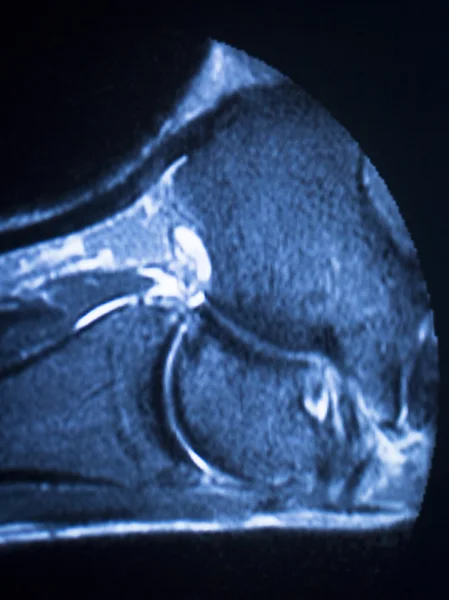 МРТ магнітно-резонансна томографія сканування щиколотки — стокове фото