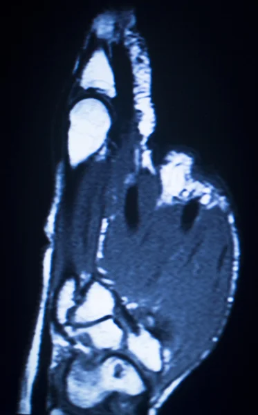 MRI magnetic resonance imaging-medische scan — Stockfoto