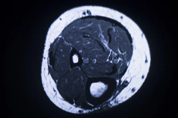 Mri 磁共振成像医学扫描 — 图库照片