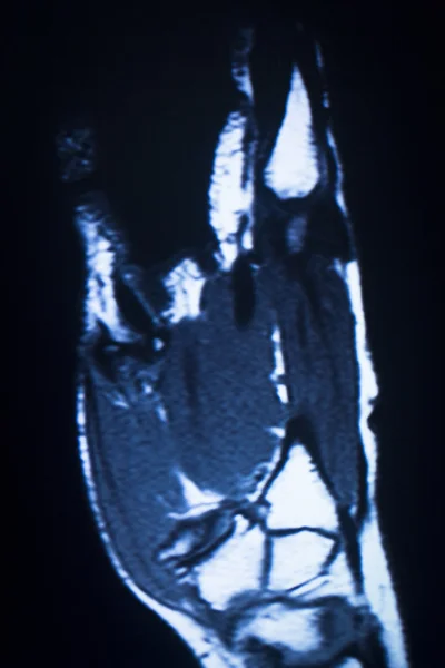 Mri 核磁気共鳴医学 — ストック写真