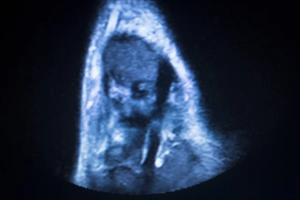 Mri 磁共振成像踝关节扫描 — 图库照片