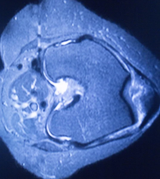 Mri 磁共振成像医学扫描 — 图库照片